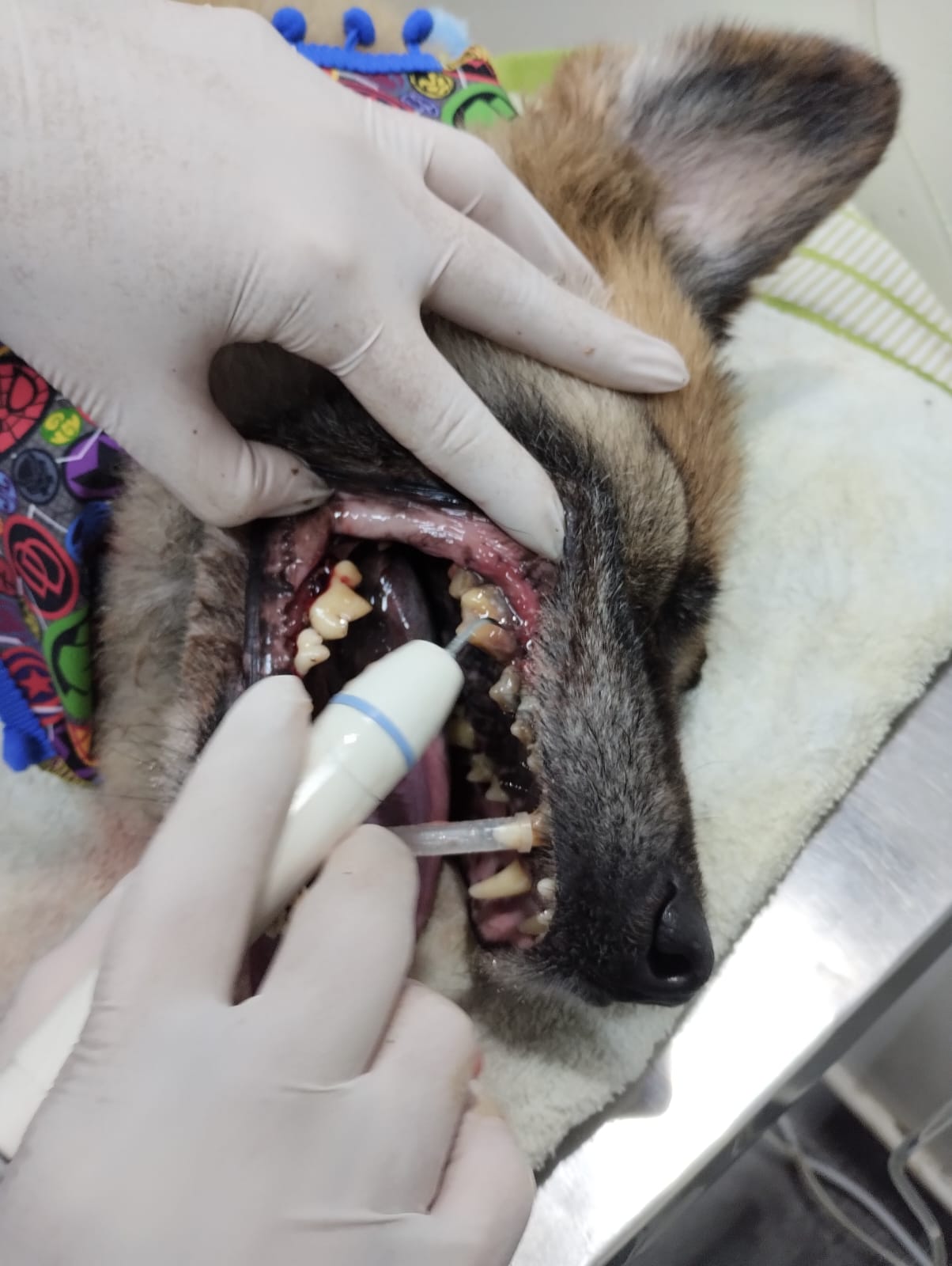 Profilaxis dental
